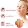 Blackhead Remover Pore Vacuum with 4 Suction Blackhead Extractor Tool Cleaner Blackhead Sucker for Women and Men