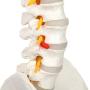 Axis Scientific Spine Model, 34'' Life Size Spinal Cord Model with Vertebrae, Nerves, Arteries, Lumbar Column, and Male Pelvis, Includes Stand, Detailed Product Manual and Worry Free 3 Year Warranty