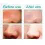 Best Blackhead Remover Vacuum Pore/Acne Cleaner Comedo Suction, LED display, USB rechargable with Bonus Blackhead Tweezer Set and Silicone Face Brush