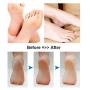 BOMPOW Foot Scrubber Electric Callus Remover Rechargeable Foot File Hard Skin Remover Pedicure Tools Electronic Callus kit for Cracked Heels and Dead Skin with 2 Roller Heads, Blue