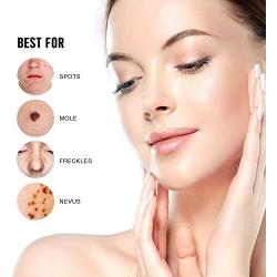 Ariella Removal Treatment-Made of Natural Plant Extracts-Simple and Easy to Apply Skin Tag Remover & Mole Corrector and Repair Lotion Set,