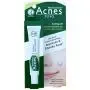 Mentholatum Acnes Anti - Acne Treatment Prevent Pimple Sealing Jell 18g