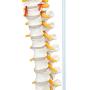 Axis Scientific Spine Model, 34'' Life Size Spinal Cord Model with Vertebrae, Nerves, Arteries, Lumbar Column, and Male Pelvis, Includes Stand, Detailed Product Manual and Worry Free 3 Year Warranty