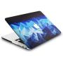 KECC Laptop Case Compatible with MacBook Pro 13'' (2021/2020/2019/2018/2017/2016) Plastic Hard Shell Cover A2338 M1 A2289 A2251 A2159 A1989 A1706 A1708 Touch Bar (Blue Diamond)