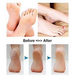 BOMPOW Electric Callus Remover Foot Scrubber, Foot File Hard Skin Remover Pedicure Tools for Feet Electronic Callus Shaver Pedicure kit for Cracked Heels and Dead Skin with 2 Roller Heads, Pink