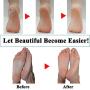 7 Extra Coarse & 7 Regular Coarse Replacement Roller Refill Heads Compatible With Pefect Electronic Foot File