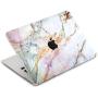 Timocy Hard Case Compatible with MacBook Retina 12 Inch – Marble Laptop Case with Keyboard Cover, Screen Protector, Touch Pads Sticker – Enhanced Protection – Gorgeous Designs, Star Marble