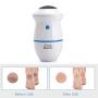 Electric Adsorption Foot Grinder, Pedicure Foot Care Tools, Speed Callus Remover for Dead Hard Cracked Dry Skin (Foot Grinder White)