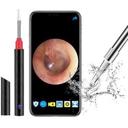 MSQL Wireless Otoscope Earwax Removal 1080P HD WiFi Ear Wax Remover Endoscope with Blue Light Disinfection Light, for Children, Adults, Pets