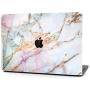 Timocy Hard Case Compatible with MacBook Retina 12 Inch – Marble Laptop Case with Keyboard Cover, Screen Protector, Touch Pads Sticker – Enhanced Protection – Gorgeous Designs, Star Marble