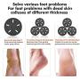 Electric Foot file callus remover for foot, USB Electronic Foot FilePedicure Tools, 3 Professional Electronic Feet Care Grind Head,Pedicure Foot Care Tools for Dead Hard Cracked Dry Skin