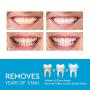 Blitzby Teeth Whitening Pen 3pcs, Upgraded Formula, 50 Plus Uses Effective, Painless, No Sensitivity, Travel-Friendly, Easy To Use, Beautiful White Smile (3 PCS)