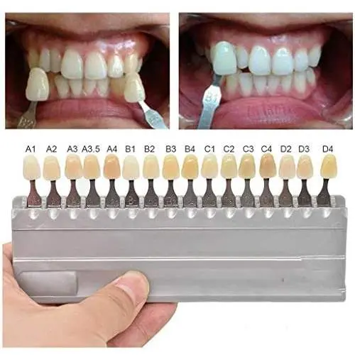 1 Set 16 Colors 3D Teeth Whitening Shade Guide Porcelain - Tooth Bleaching Shade Chart Mold - Tracking & Comparing - Dental Equipment Dentist Material - Professional or Household Oral Care (White)