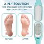 Callus Remover For Feet | Double-sided Dead Skin Remover - Rough Pedicure Foot File For Exfoliation & Fine Foot Scrubber for Smoothing & Softening Skin
