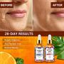 Vitamin C Serum, Retinol Serum - Envisha Day and Night Serum 2-Pack - Face Serum for All Skin Vitamin C Serum, Retinol Serum - Envisha Day and Night Serum 2-Pack - Face Serum for All Skin