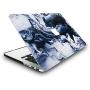KECC Laptop Case Compatible with Old MacBook Pro 13'' (CD Drive) w/Keyboard Cover + Sleeve + Screen Protector (4 in 1 Bundle) Plastic Hard Shell Case A1278 (Black Grey Marble)