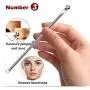 Musment 5PCS Blackhead Remover, Pimple Tool Kit, Acne Tools