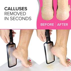 GENUINE Professional Pedicure Foot File, Foot Rasp, Foot Callus Remover, Scrubber Foot Scraper for Dead Skin Remover Heel Scraper for Feet MEGAFILE Egg Ped Pedi Pumice Stone For Feet