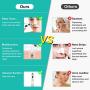 Blackhead Remover Pore Vacuum/IVETTO Blackhead Vacuum Face Acne Removal Blackhead Extractor Device/USB Rechargeable with 5 Probe heads