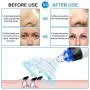 Blackhead Remover, Pore Vacuum Electric Blackhead Vacuum Extractor Clean Tool - Comedo Pore Beauty Device with 6 Probes for Blackhead Remover Vacuum Suction Cleanser Microdermabrasion Pimple Extractor