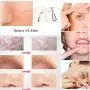 Musment Blackhead Remover 5pcs Kit with Portable Box