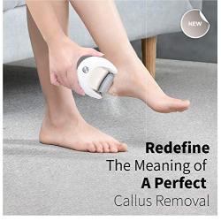 NågraCoola Electric Feet Callus Remover,Rechargeable Electronic Foot File|Callous Scrubber|Exfoliator| Grinder|Buffer|Smoother|Sander|Pedicure Kit,Professional Pedi Tool Best for Foot Care|Crack Heel