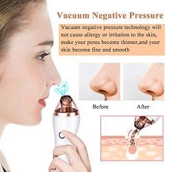 Blackhead Remover Pore Vacuum with 4 Suction Blackhead Extractor Tool Cleaner Blackhead Sucker for Women and Men